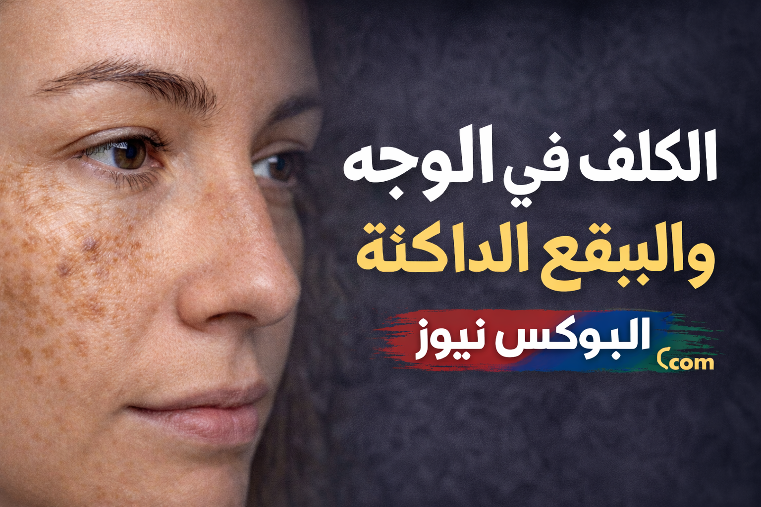 علاج الكلف في الوجه نهائياً والتخلص من البقع الداكنة بخطوات فعّالة